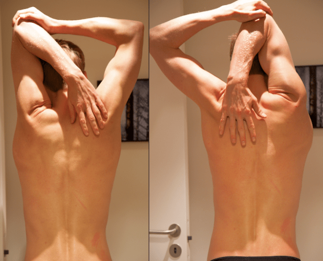 Triallan - Klinikk for Alle - Svømming - Fleksibilitet - Skadeforebyggning