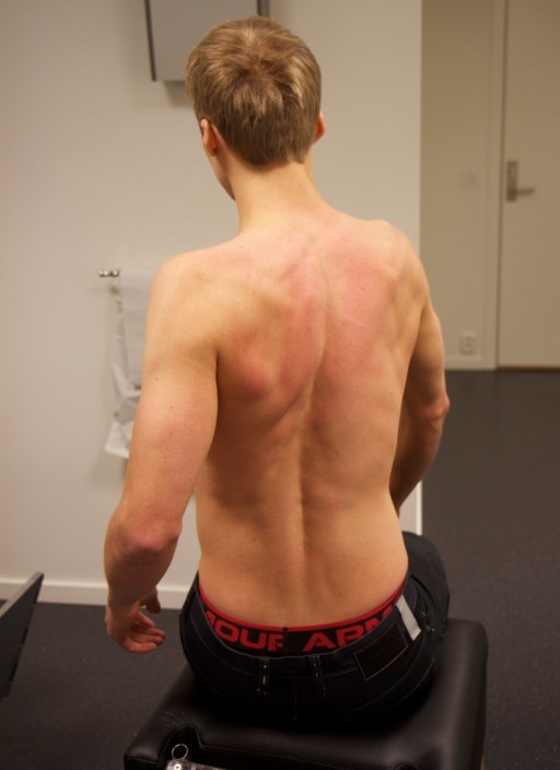 Triallan - Klinikk for Alle - Svømming - Fleksibilitet - Skadeforebyggning