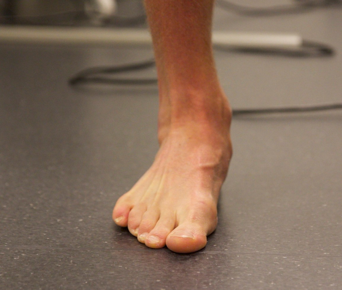 Triallan - Klinikk for Alle - Formthotics