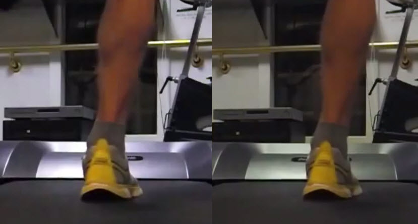 Triallan - Formthotics - Klinikk for Alle - Pronasjonskontroll