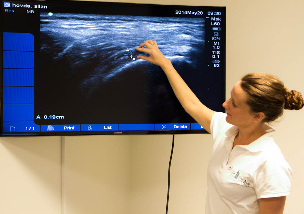 Triallan - Klinikk for Alle - Hofteskade - Kiropraktor Cahtrine Hoff