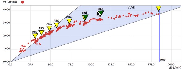 Allan Hovda - ventilatory